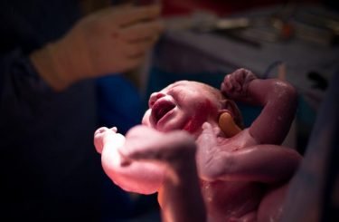 birth injury newborn