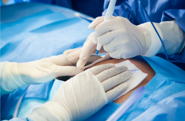 Doctors performing a c-section