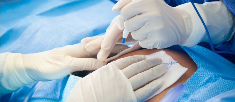 Doctors performing a c-section