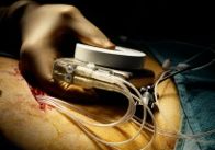 DOJ Defibrilator Investigation photo