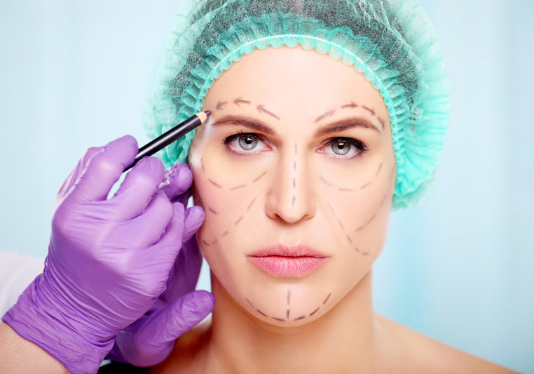 marking on face of beautiful woman, plastic surgery